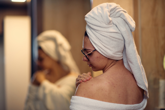 Woman applying moisturizer to skin after shower, addressing dryness from hard water mineral buildup